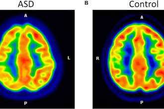 machine learning medical image analysis
