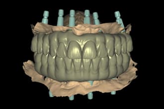 design all on x prosthesis with dsd using exocad