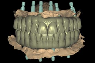 design all on x prosthesis with dsd using exocad