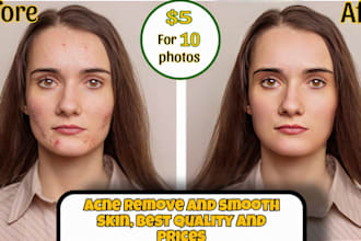 remove pimples, acne,blemish retouch your skin acne scars