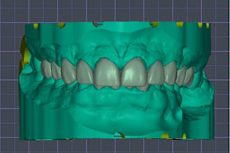 design full anatomic crowns