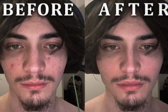 professionally retouch your skin , and your photo