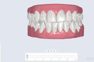 dental modeling archform orthoplan exocad 3shape