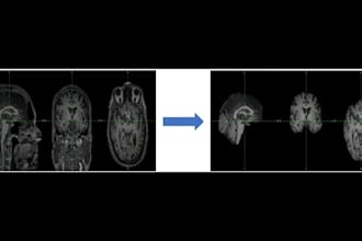 preprocess your mri images