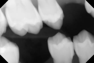do dental billing with 100 percent accuracy