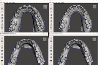 high quality dental 3d file meshing with meshmixer