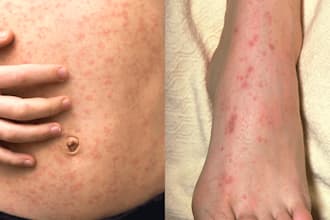 help you solve your skin problem being a dermatologist