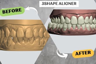your design clear aligner orthodontic case with 3shape ortho
