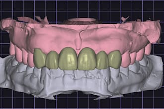 exocad técnico diseñador dental