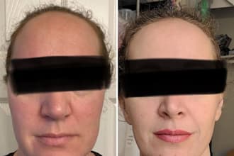 solve your skincare issue as a dermatologist