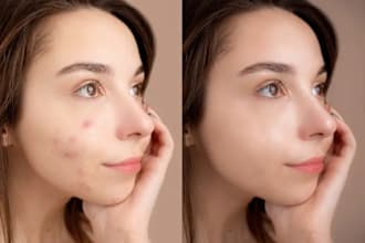 retouch your skin, remove your pimples and acne