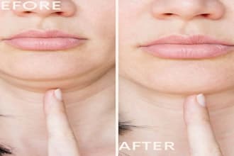 remove double chin body fats and reshape your body
