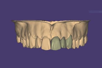 design crowns and bridges