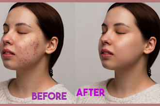 do professional high end skin retouching