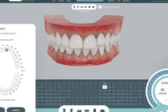 create clearaligner treatment plan including ipr and attachment with stepping