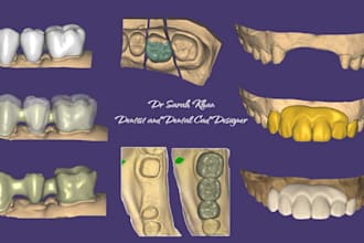 design crown, bridges, smile, veneer  dental cad using exocad