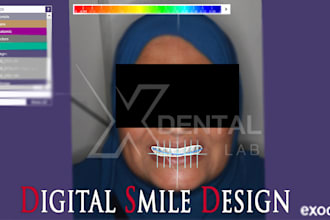 do digital smile design in exocad, first crown is free