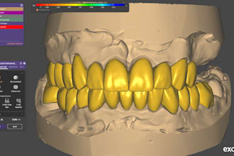 provide dental design support