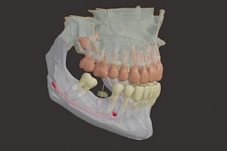 create a 3d biomodel printable  for surgical plans