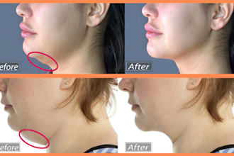 get rid of double chin and reduce double chin fat