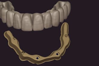 dental design for hybridbridge