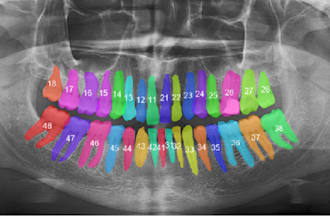 annotate dental x rays, fdi numbering and dental mri images
