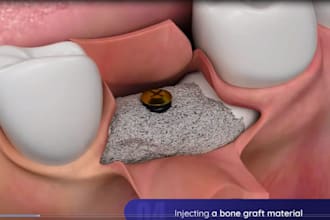 make 3d dental medical animation for skeleton, virus, anatomy and surgery video