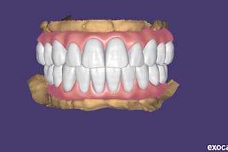 design smile, veneers, crown, bridge, implants using exocad