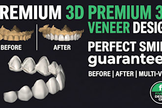 design 3d printed and milled veneers