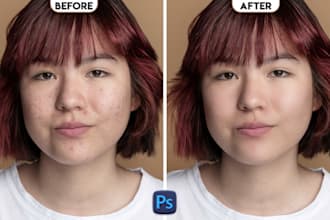 retouch your skin, remove your pimples, acne retouching