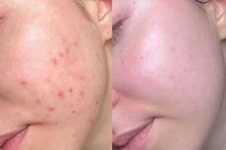 solve your skin and hair problem being a dermatologist