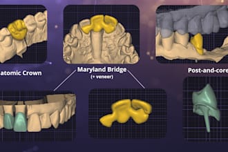 design crowns, bridges, onlays, maryland etc in exocad