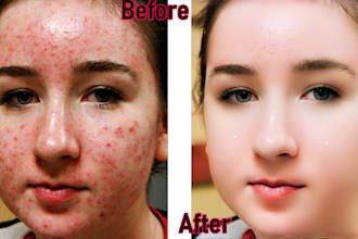 skin retouching, photo editing, face retouch
