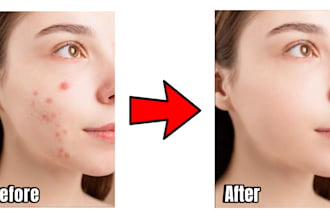 retouch your skin, remove your pimples in photoshop