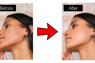 retouch your skin, remove your pimples in photoshop