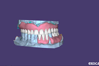design top notch dental crowns bridges and dentures