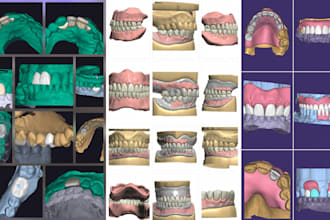 design top notch dental crowns bridges and dentures