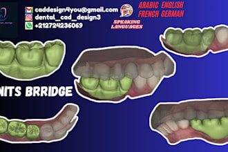 design crowns  bridges  veneers using exocad