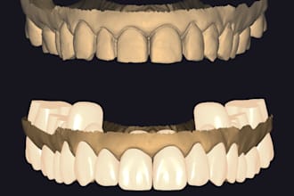 design a diagnostic waxup in exocad