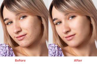 do skin retouching, remove wrinkles and pimples in 24 hours