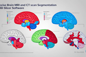 do brain mri ct scan segmentation with 3d slicer for neuroscientific research