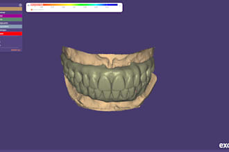 design a full mouth hybrid prothesis on exocad