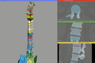 integrate ai models and fine tune them for medical imaging