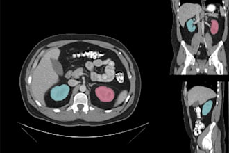 assess and fine tune medical imaging ai with monai and pytorch