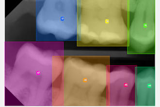 accurately annotate dental xrays for ai training