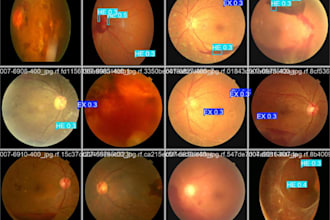 classify eye disease retinal images using deep learning