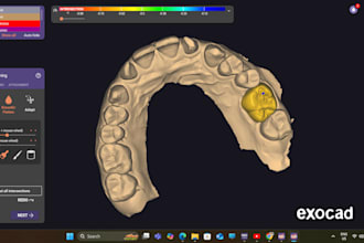 create custom 3d dental crown designs for your patients