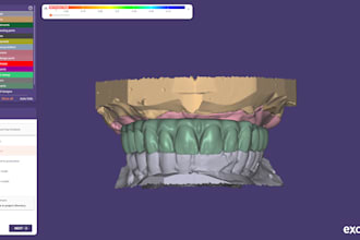 design snap on smile for 35euro per arch