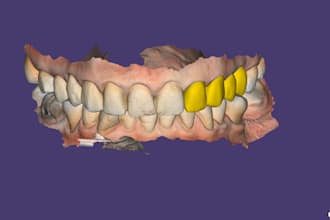 do dental design using exocad software based on your scans