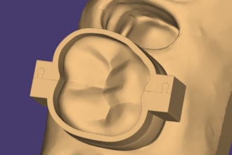 do dental cad design planning for aligners